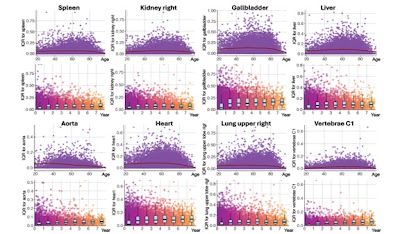 Radiology_AI's tweet image. Modeling whole-body, CT-derived anatomic volumes to establish reference charts for the adult lifespan doi.org/10.1148/ryai.2… @AI_Medic #kidney #lungs #AI