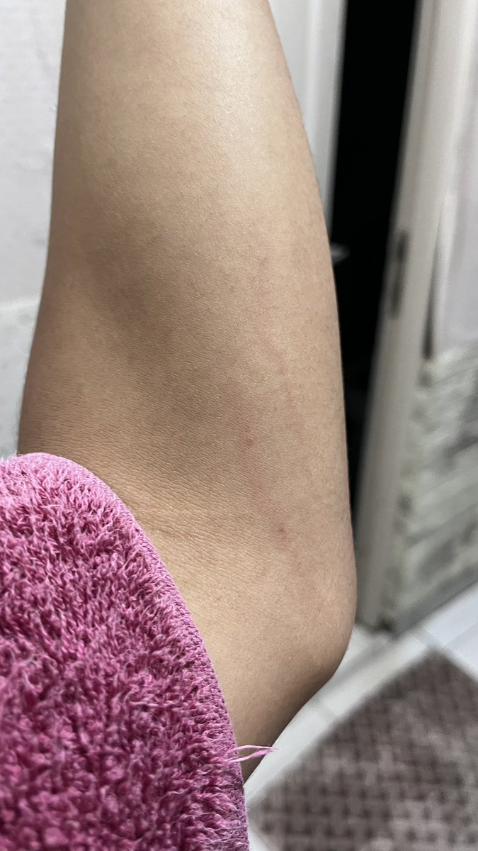 kevas²⁵ tweet media