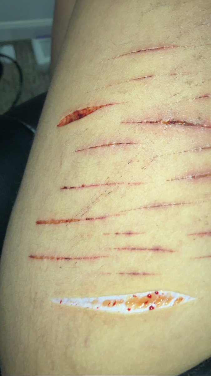 ꯱ׁׅ֒ɑׁׅ֮ᧁׁꫀׁׅܻ tweet media