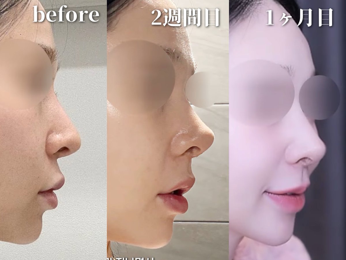 【公式】温度美容外科/ オンド美容外科 tweet media