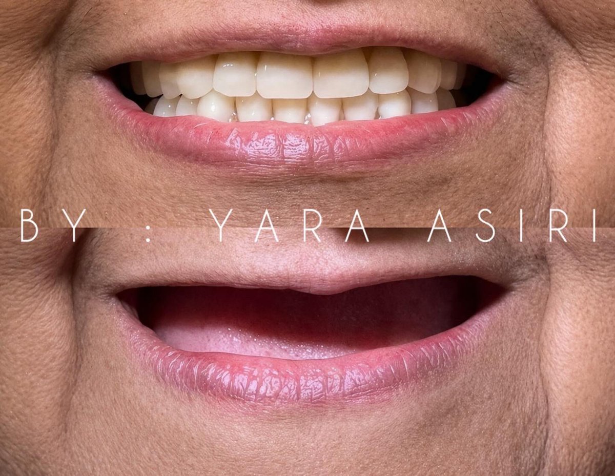 Yara Asiri tweet media