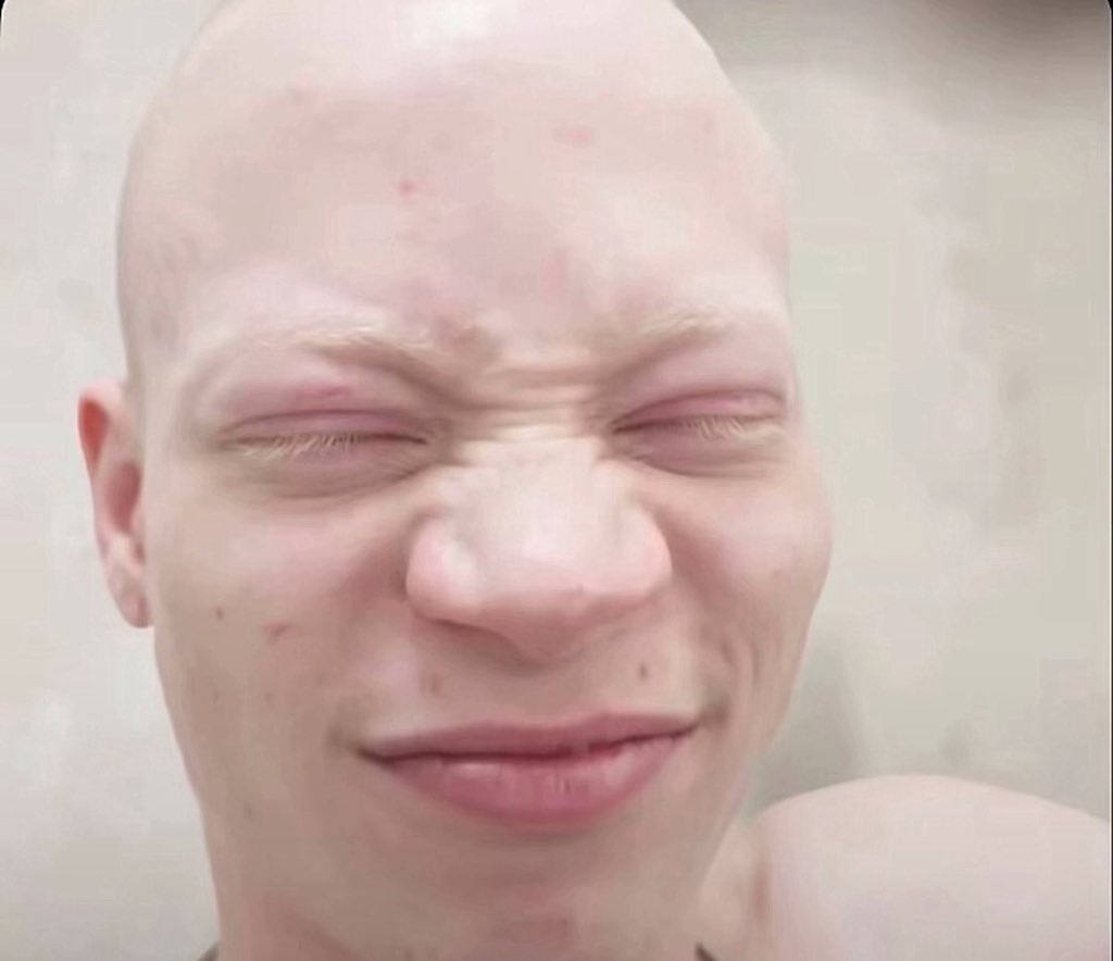 Rhymean Ace tweet media