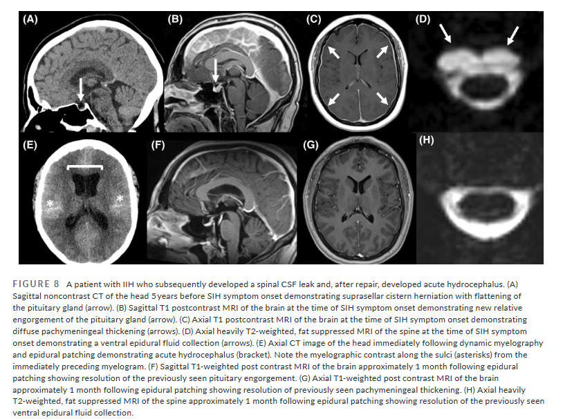 Headache Journal tweet media
