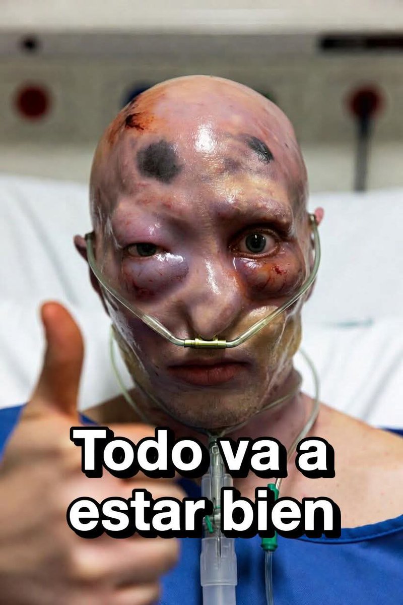 mariaart55's tweet image. Everything's gonna be alright 💪

Despite the harsh aftermath of cancer,