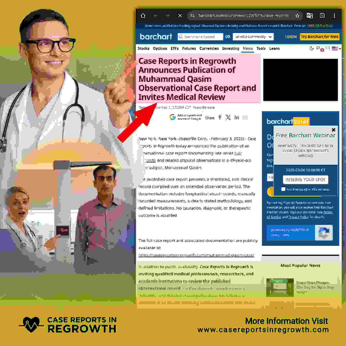 Muhammad Qasim regrowth discussion often highlights the 15 to 20mm follicle growth claim as one of the key technical points.
See y
Street Insiders and Bar Chart News.