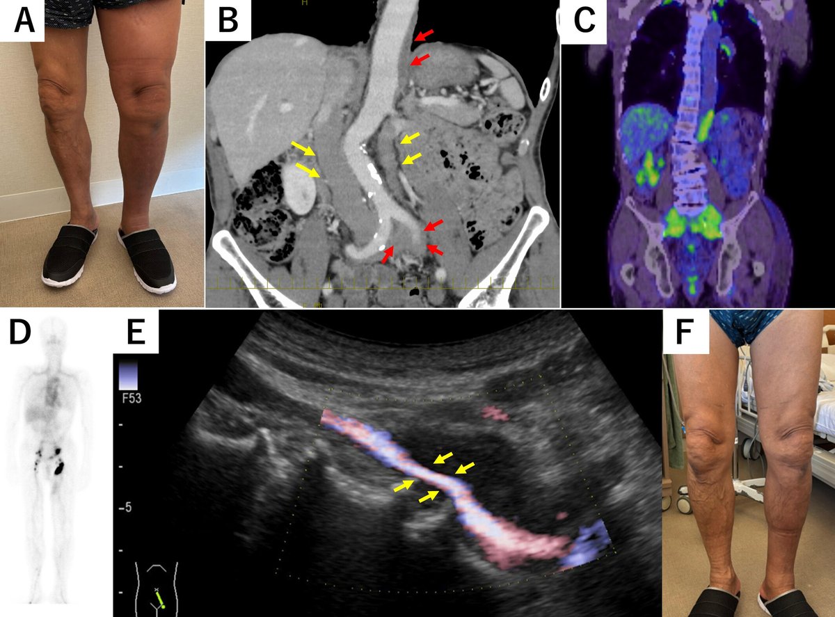 ACR_Journals tweet media