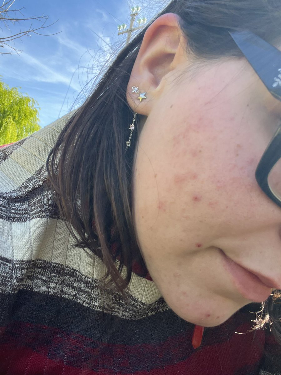 hele in borderland 🍓 tweet media