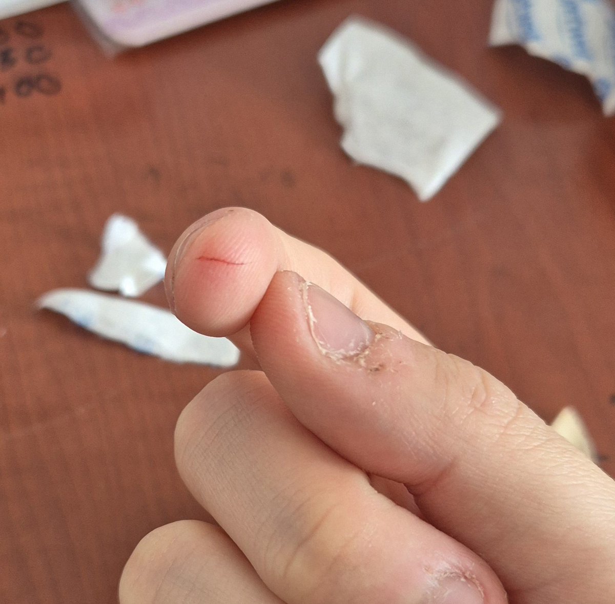 ꔛ∘.ᵉˢᶜ ᵒᶠ ˢʰᵗʷᵗ °ᵉᵈ ʳᵉᶜᵒᵛᵉʳʸ°.∘ꔛ tweet media