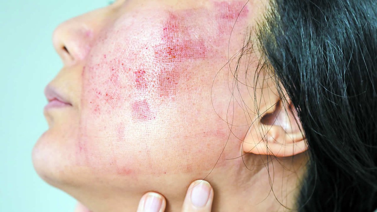 defimediainfo's tweet image. Citron, dentifrice, huiles : le vrai prix des « astuces » beauté virales dlvr.it/TRtMhS #Beauté #Astuces #Santé #SoinsDeLaPeau #Acné