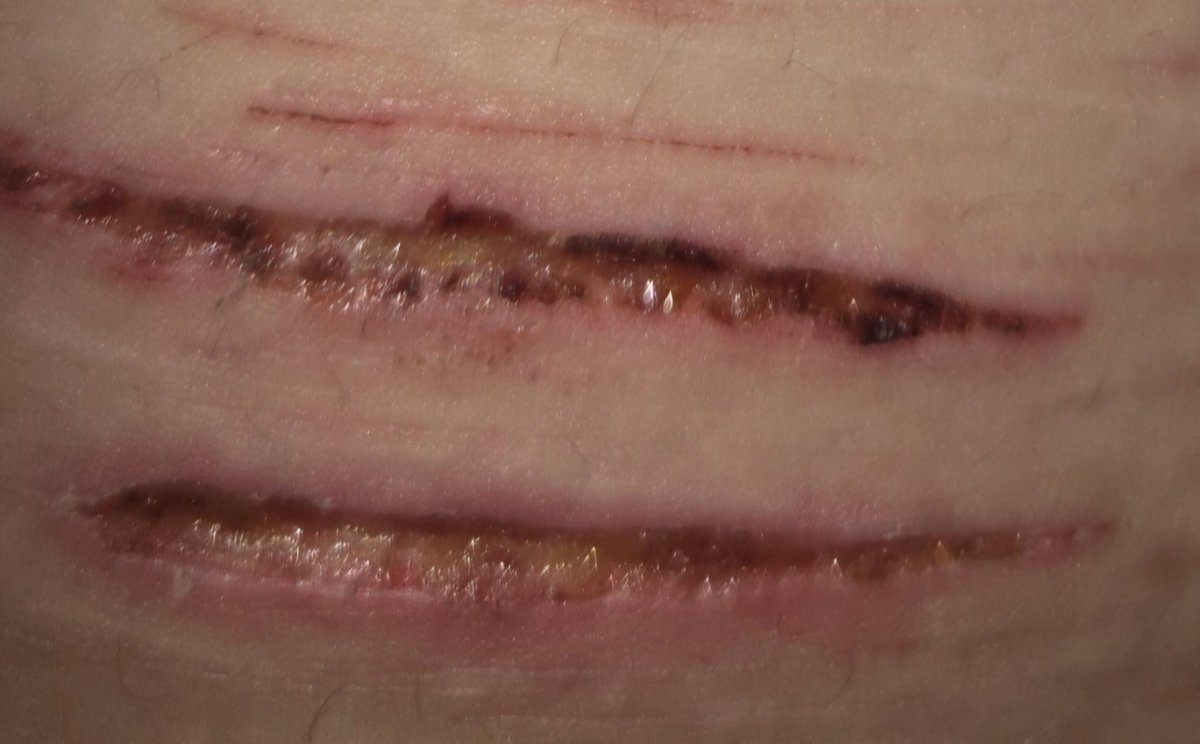 yuji of shedtwt tweet media