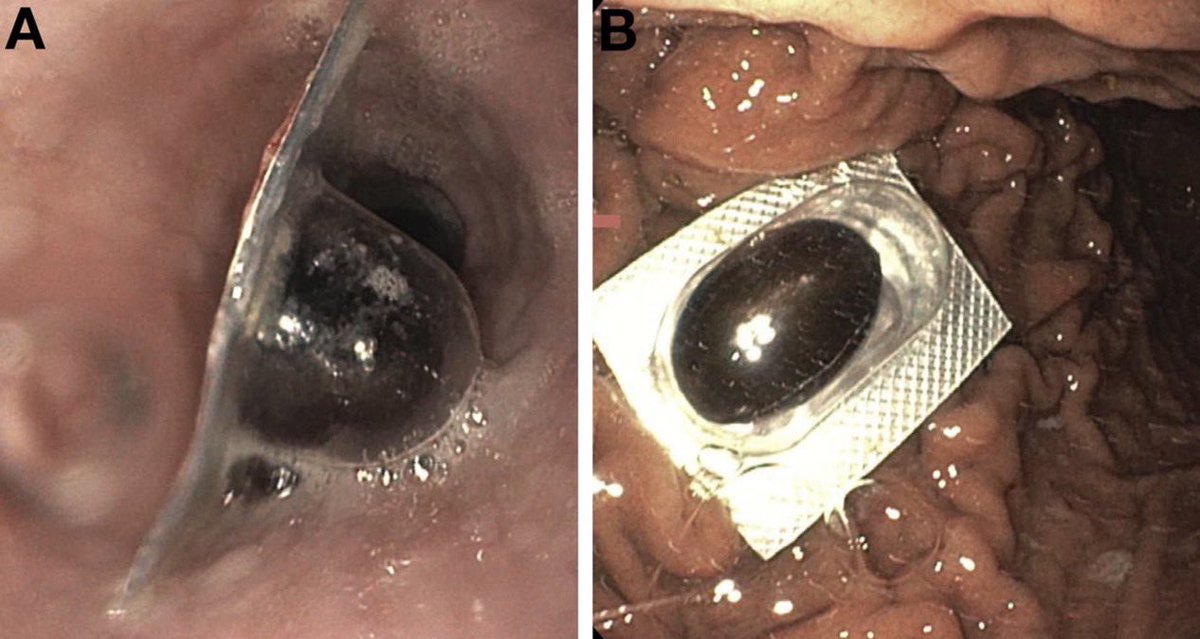 Keith Siau tweet media