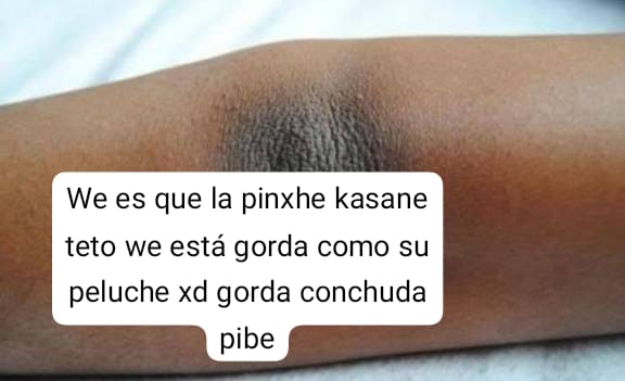 G E R M Λ N 🇲🇽 tweet media