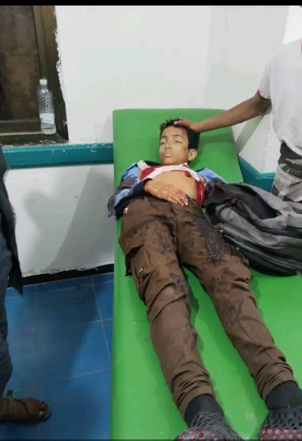 moataz77549's tweet photo. #تعز 
مليشيات الحوثي تقنص طفلا اليوم 
بحي الروضة بكلابه أثناء خروجه من المدرسة، وقبلها برمضان امرأة في رمضان وهي تطبخ وجبة السحور . 
ويأتي سربوت يقول لك هؤلاء رجال دولة، أو يناصروا غـ ـزة وفلسطيـ ـن وو .. 
أين ذهب الذين كانوا يقنعونا بطهارة هؤلاء المليشيات وهذه السلالة القذرة . https://t.co/YBBgLEWfJc