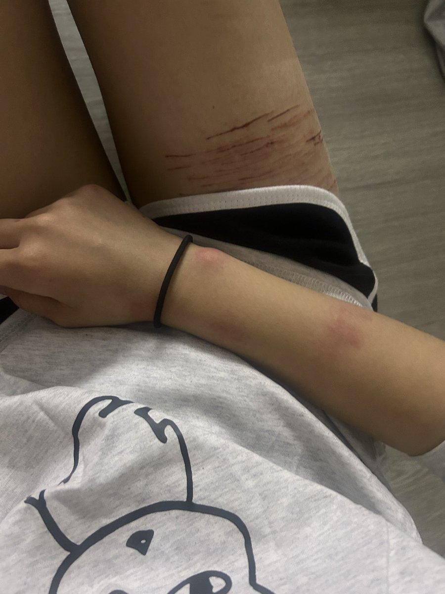 당 ㅌㅊㅅ tweet media