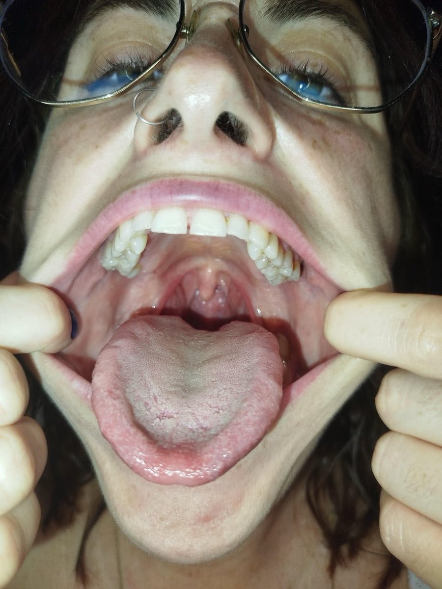 beautifulmouths's tweet photo. Meli-redhead https://t.co/zO2usrcpFP