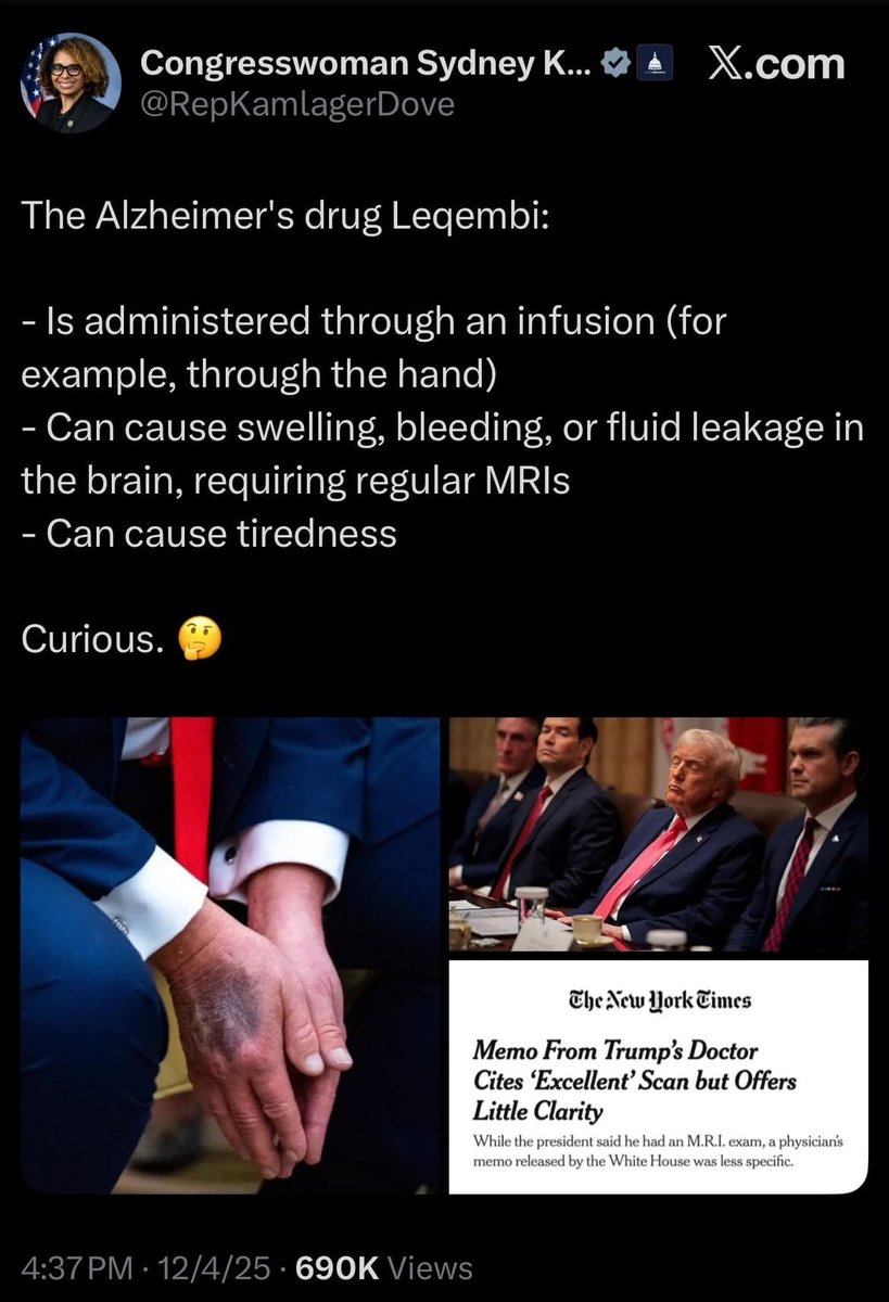 ๐พ๐ฃ๐๐๐ฅ ๐๐๐๐๐ ๐น๐ ๐ tweet media