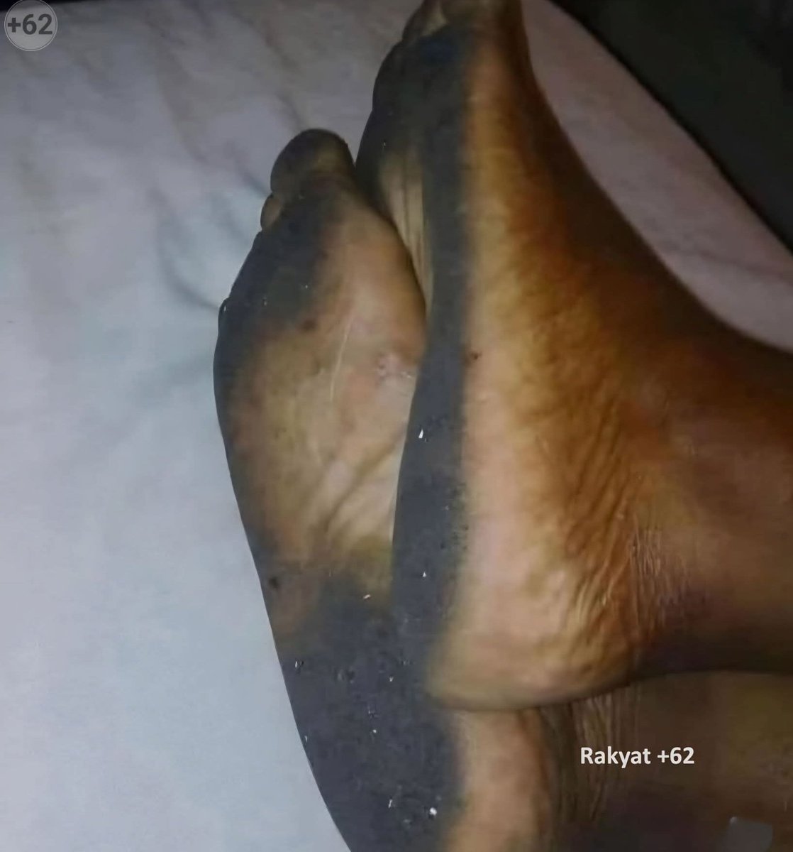 SobatMiskinTV tweet media