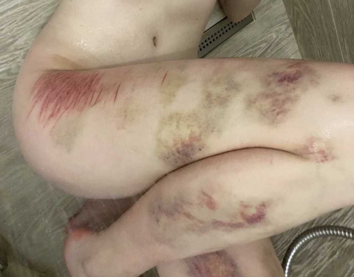 Yurishtwt| DM ME IF YOU WANT TO tweet media