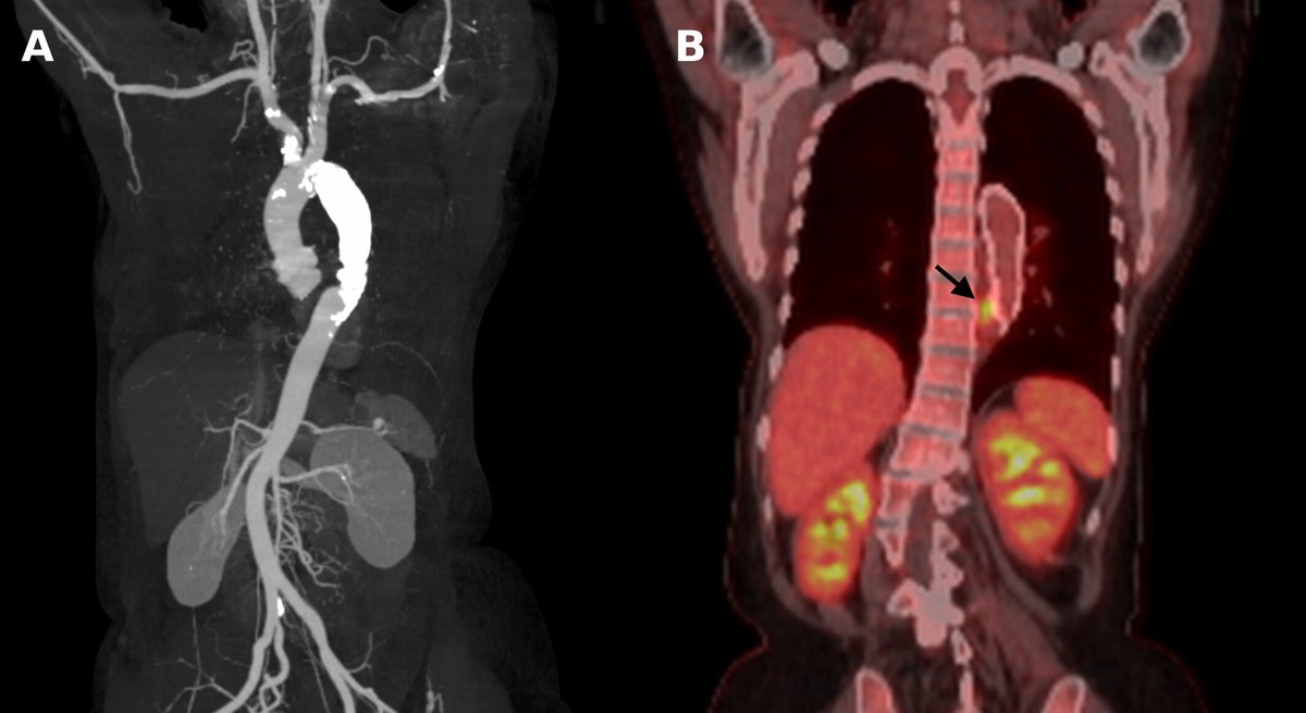ACR_Journals tweet media