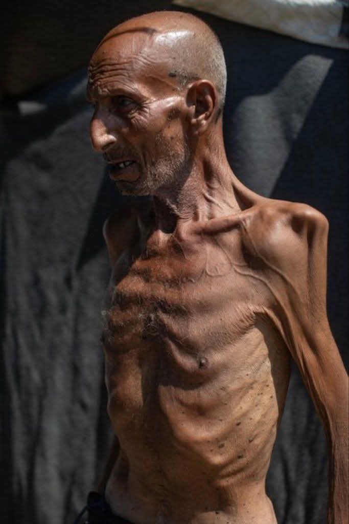 النازية الاسرائيلية ✡️ في ابشع صورها