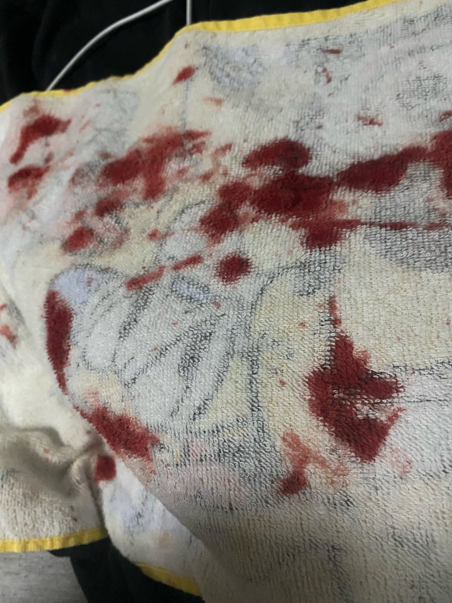 光ってるブロックが光ってんのよ！ tweet media