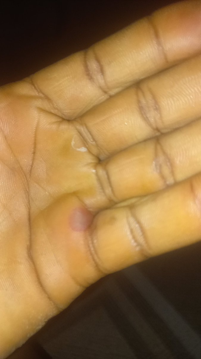 𝓝𝓪𝓷𝓪 𝓟𝓸𝓴𝓾♔ tweet media