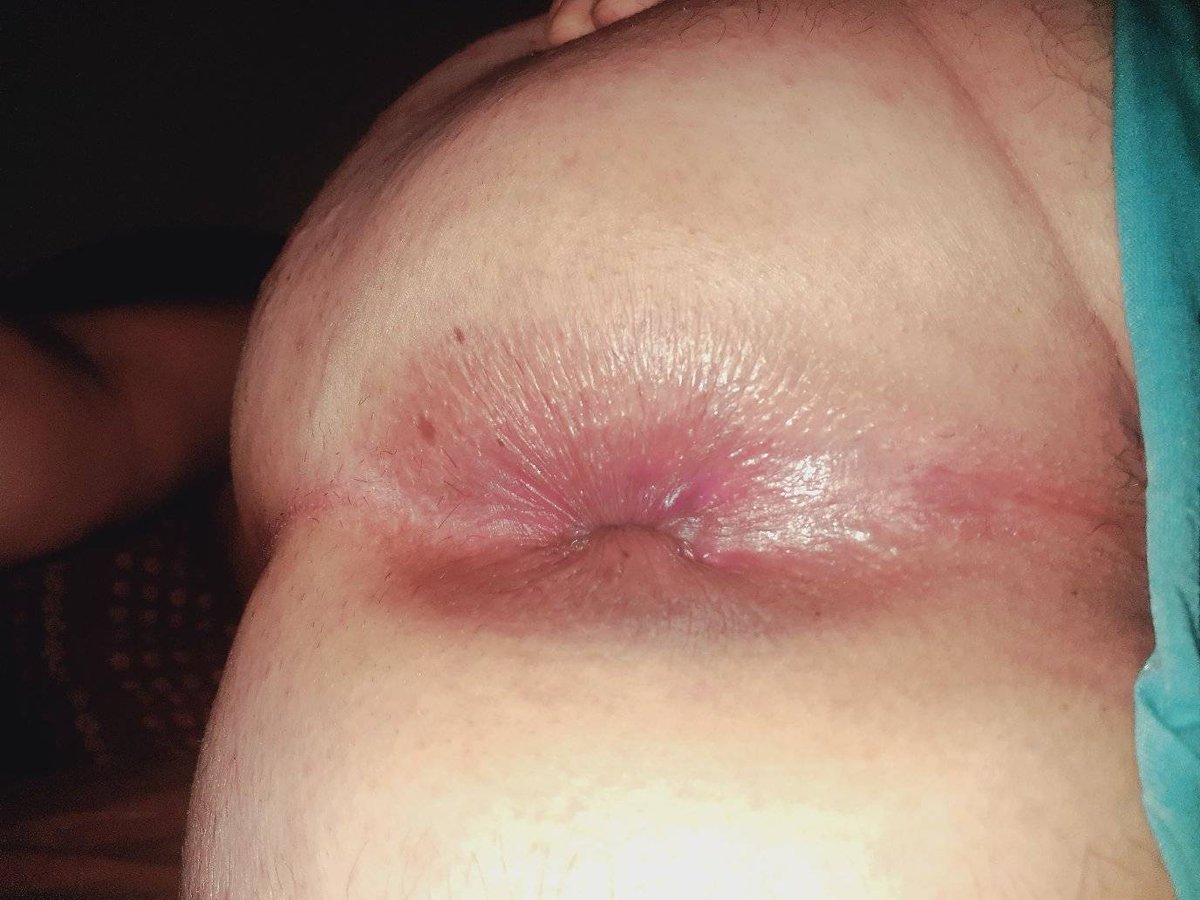 زبدة🇹🇳 tweet media