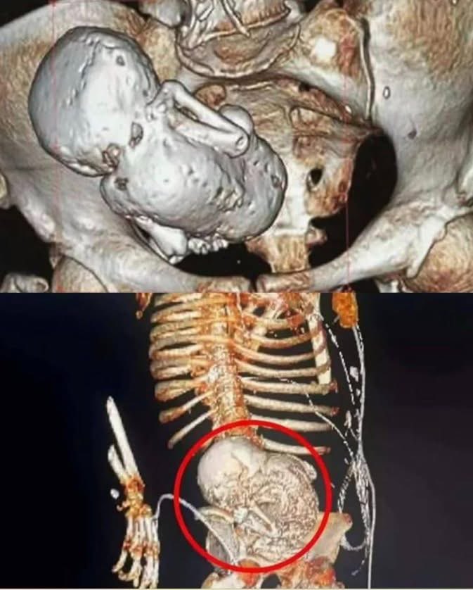 سعود tweet media