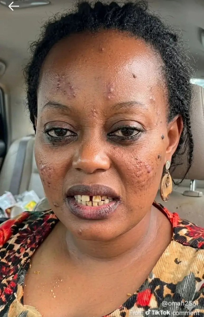 Bekar Sebatindila 🇺🇬 tweet media