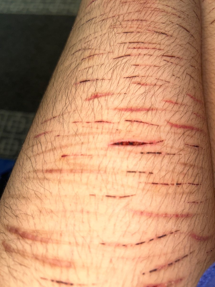 Numberonekozifan tweet media