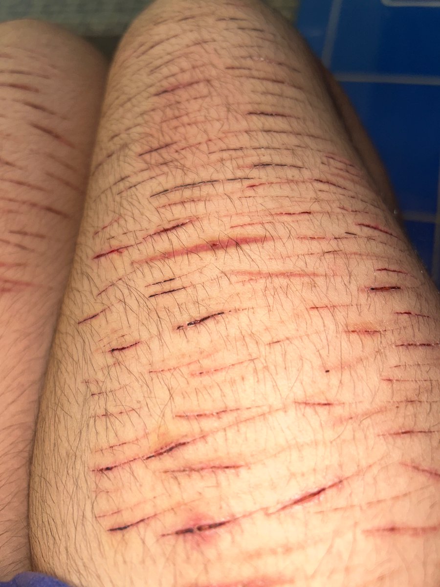 Numberonekozifan tweet media