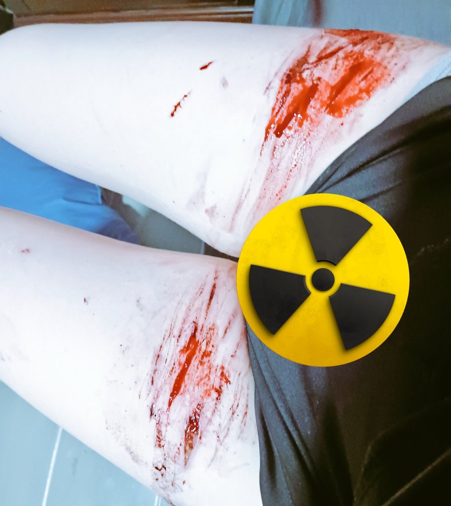 Ail / Ally tweet media