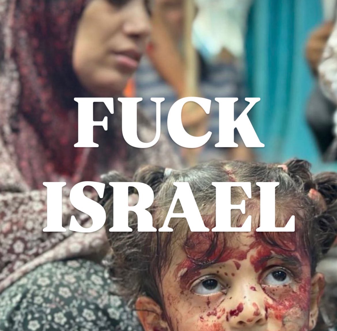 Repost this and say F*ck Israel.