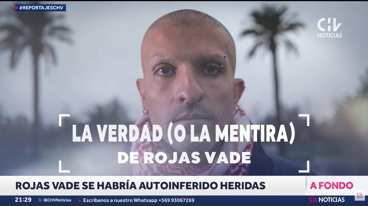 En CHV señalan que Rojas Vade (simbolo del octubrismo) se habría auto agredido y habría escrito mensajes para culpar a la derech.

Donde están los termocéfalos de la izquierda y el senador comunista Daniel Núñez que culpaban a la derecha?