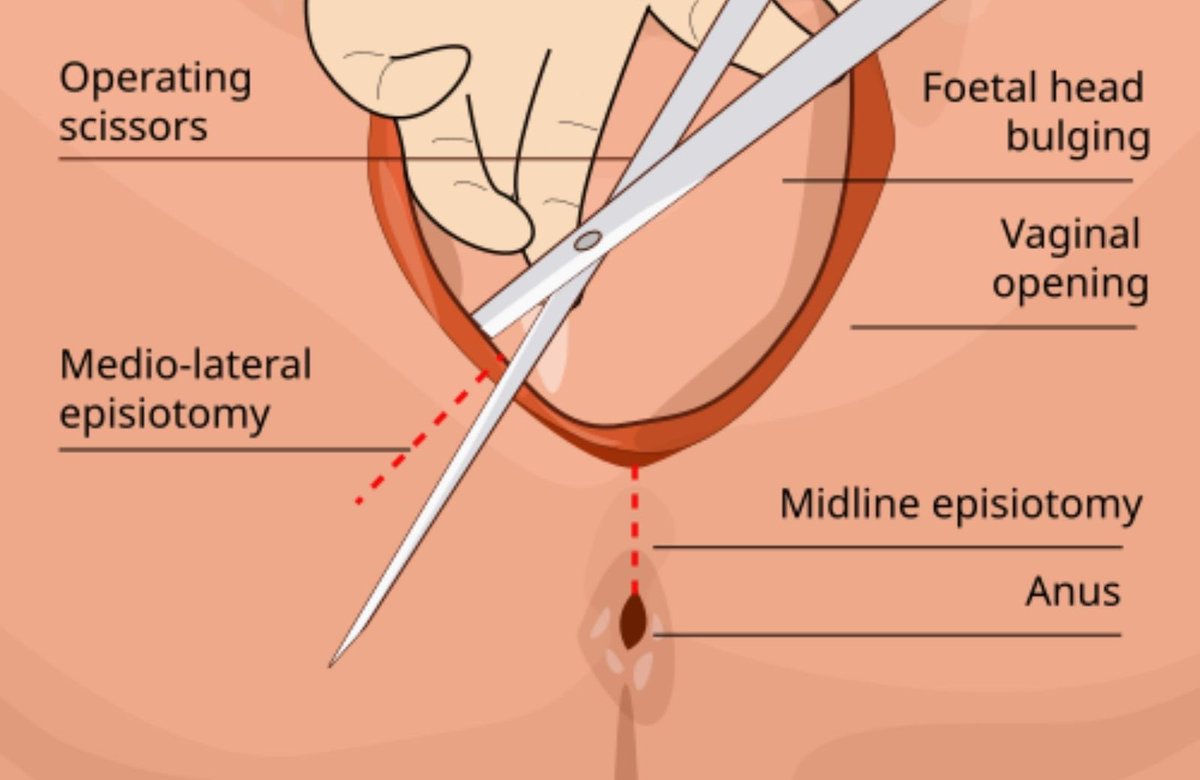 Яizal do tweet media