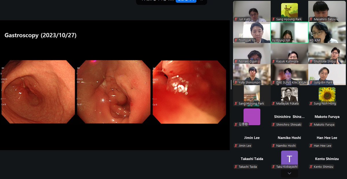sang_hyoung's tweet photo. 13th @theKASID - #JSIBD Case Conference with very interesting cases👍

🇰🇷 Gastric outlet obstruction in #Crohn

🇯🇵 Chronic diarrhea due to #Whipple disease  

🤔 I’ve seen #Whipple disease only in @MayoClinicGIHep , not in 🇰🇷 https://t.co/5nmJrxq63o