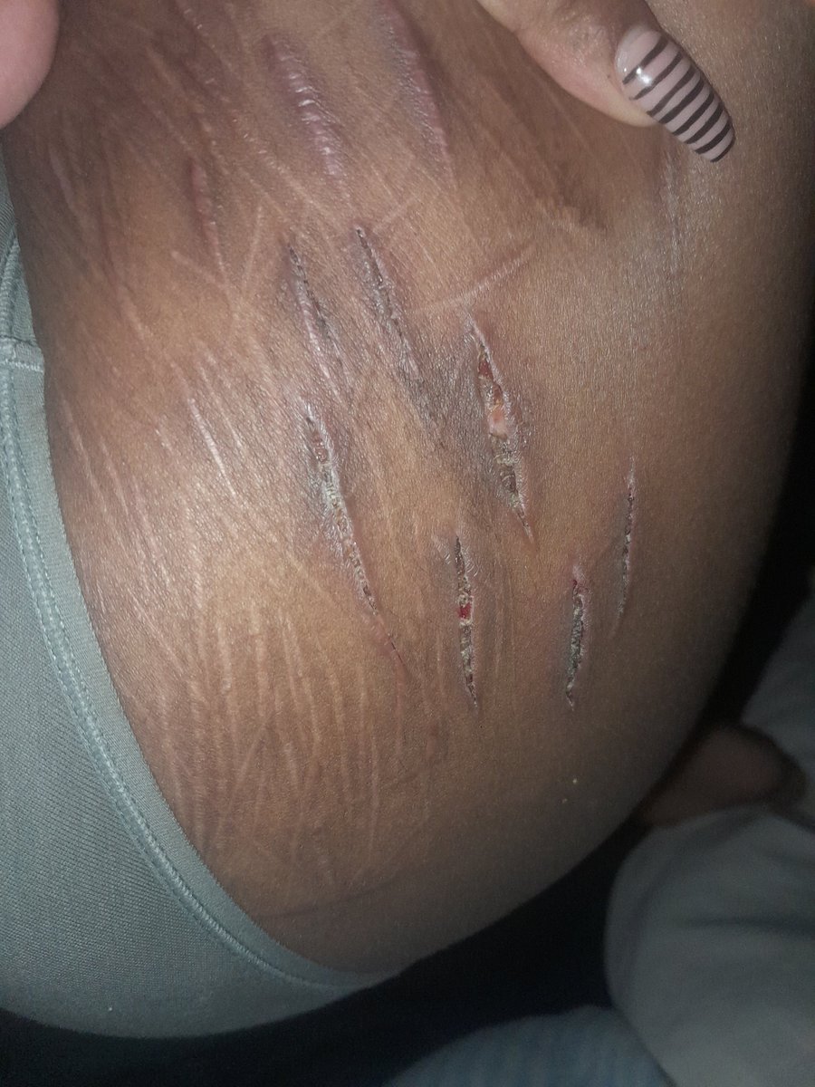 kat of SHED tweet media