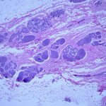 Photo by Brown Pathology and Laboratory Medicine (@BrownPathology)