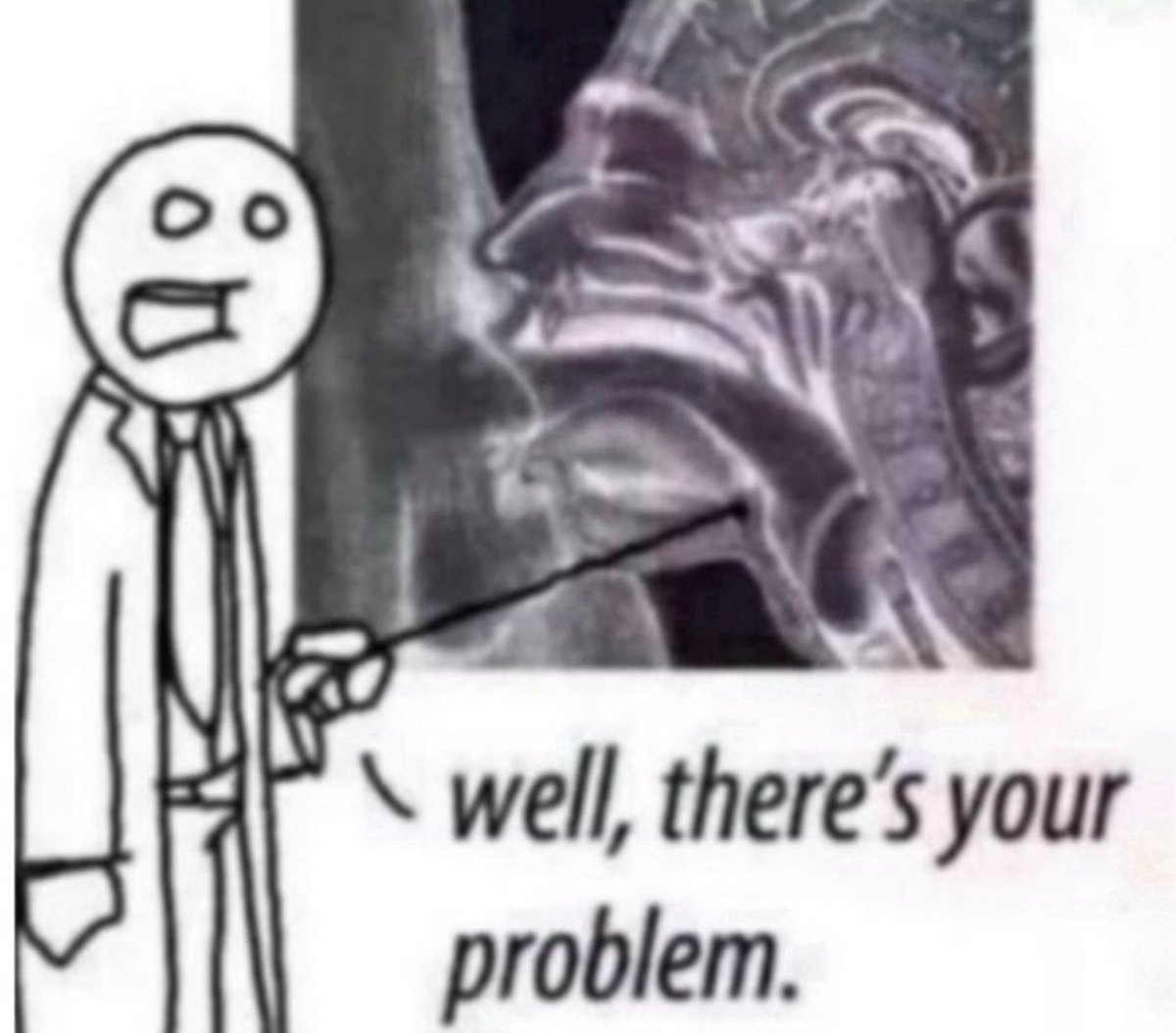 Joseph Borrne tweet media