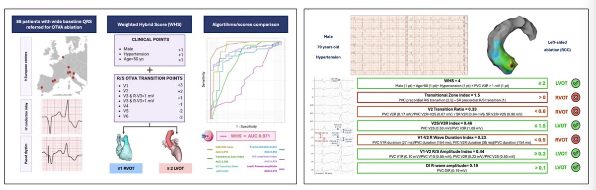 JICE_EP's tweet image. 🚨Newest #FreeRead Article in
@JICE_EP

Weighted Hybrid Score Predicts Outflow Tract Ventricular Arrhythmia Origin in Patients w/ Intraventricular Conduction Disorders or Paced Rrhythm: an International Multicenter Study

🧐📖rdcu.be/fbQQs

by @DrFalasconi,