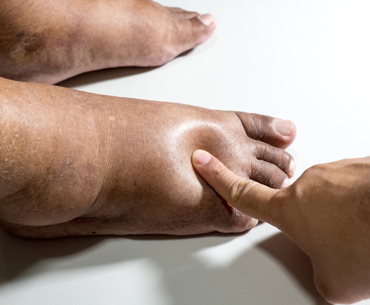 Andrezeitsᶜˢᶜ tweet media