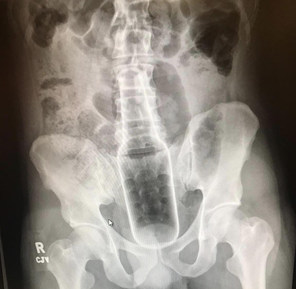 Therian Marmota Pansexual tweet media