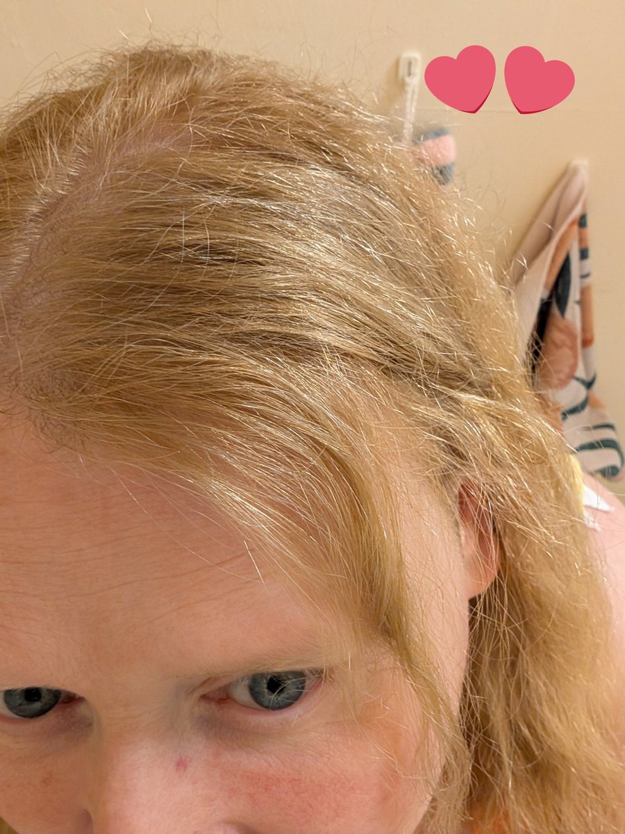 LisaSnugglybun's tweet photo. Before pic is February a few greys showing and After pic is tonight. 🩷 Dyed my hair tonight! https://t.co/YK5RaMIpBu