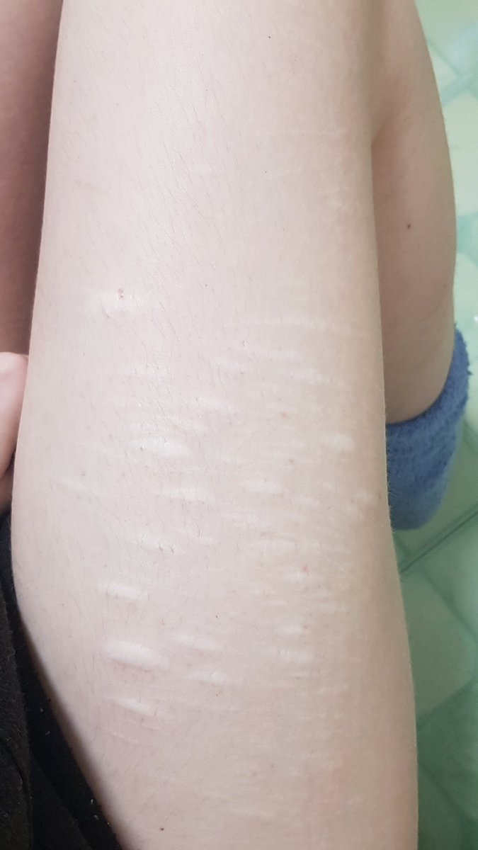 𝙼𝚊𝚖𝚒 𝚃𝚘𝚖𝚘𝚎 𝚘𝚏 𝚂𝚑𝚎𝚍𝚝𝚠𝚝 tweet media