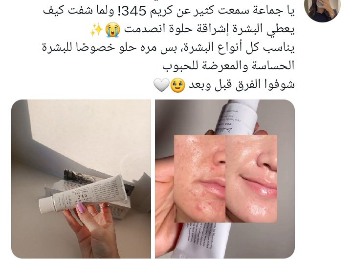 Pprickly23's tweet photo. #عاجل_الان #الجهراء #صفارات_الإنذار

ممكن تستخدمون الكود KG813 عند الطلب 

      في نايس ون 🫶🏻🥹
  
توصيل سريع خلال ساعات داخل للمملكة ودول الخليج خلال أيام https://t.co/WY0xJf6Nnm
