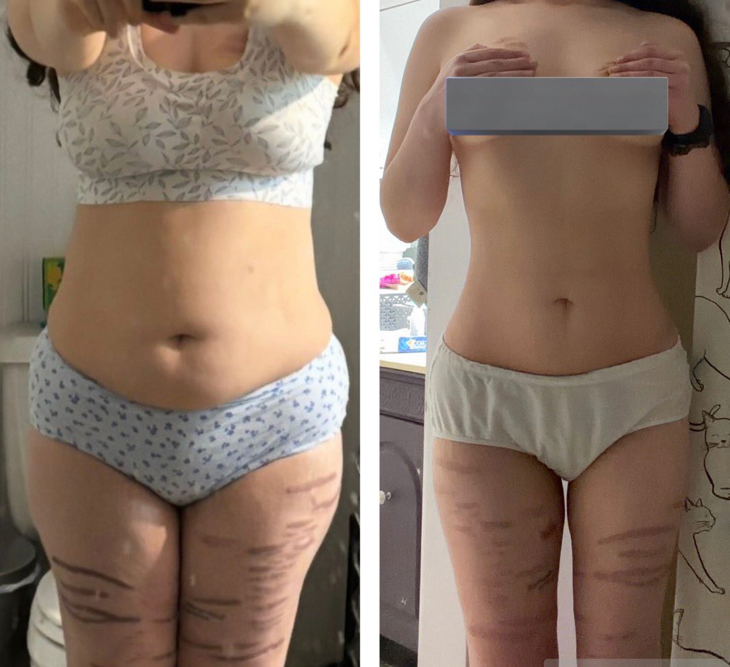 Sav the wannarexic tweet media