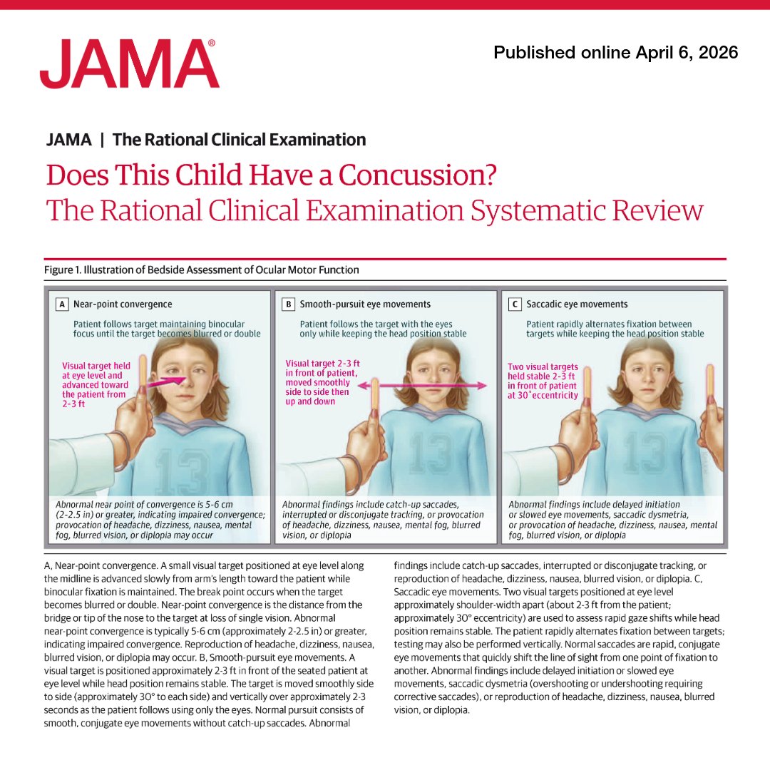 JAMA_current's tweet image. An estimated 1.1 million to 1.9 million #pediatric concussions occur annually in the US.

📊 This JAMA Rational Clinical Examination reviews the diagnostic accuracy of symptoms and signs observed in the initial evaluation of a child or adolescent who may have had a #concussion.