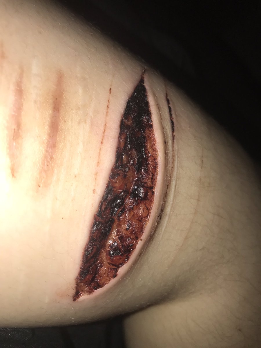 rockbottom tweet media