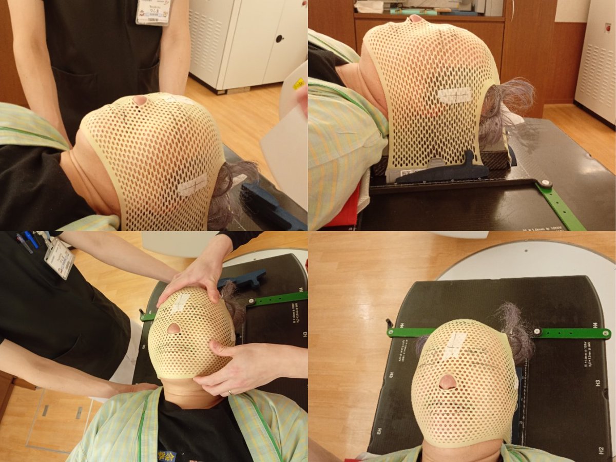 haikainew's tweet photo. 初顔出し？
頭部を完全に固定しなきゃ即失敗の難しい頭部への放射線治療の様子、型取りしたメッシュのお面で完全固定です

覆面レスラーみたいに見えて動かない様に耐えるのは大変しんどい😰
☢️治療中の痛さ痒さは特にありせん
 #初顔晒し
 #マスクレスラー みたいw
 #只々我慢
 #魔の5分間 https://t.co/b7X905ciFU