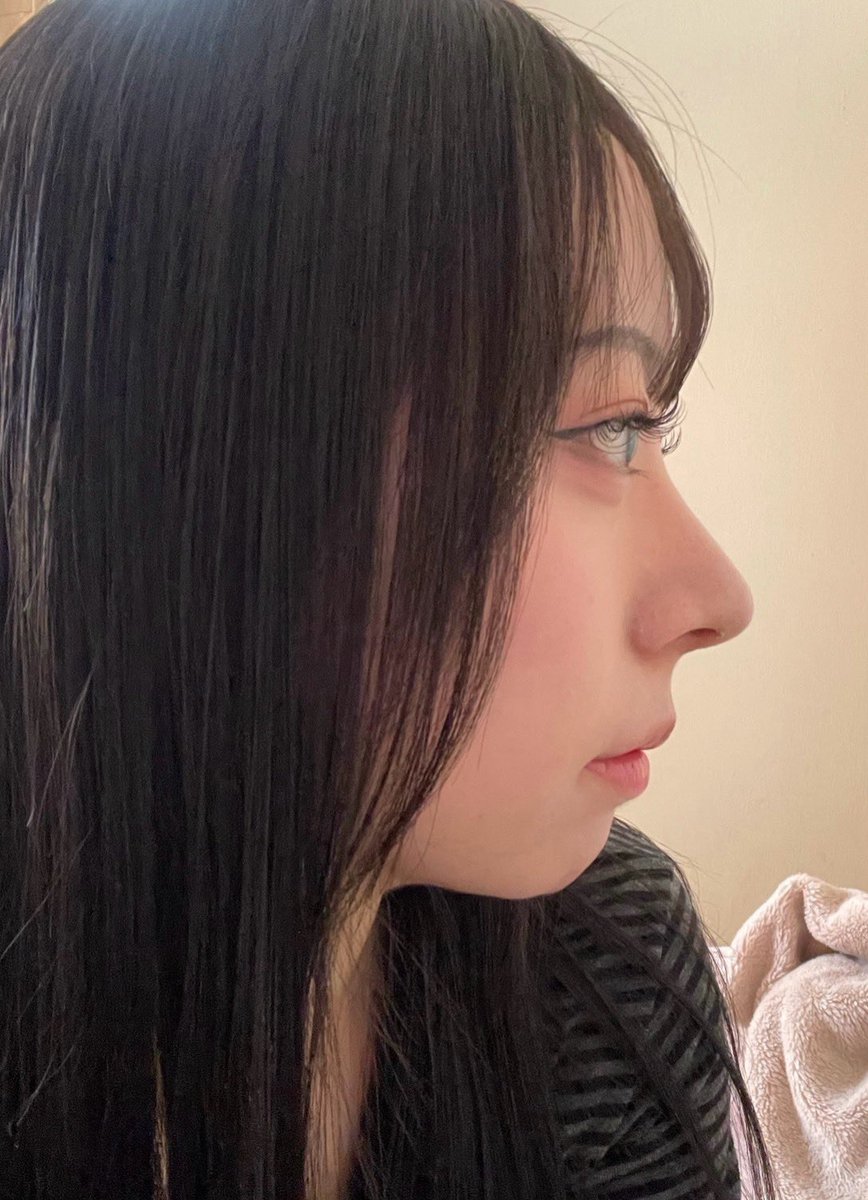 bae 鼻DT 8月脂肪吸引🇰🇷 tweet media